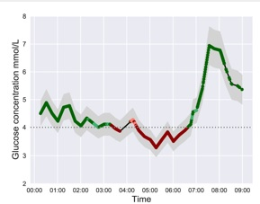 人工智能可通過(guò)心電圖檢測低血糖水平 無(wú)需進(jìn)行指尖測試