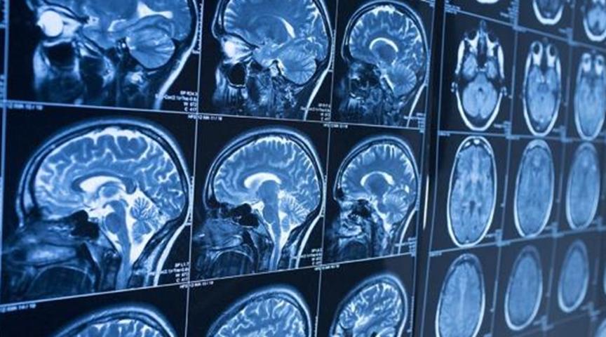 認識到深度學(xué)習的全部潛力的5個(gè)障礙