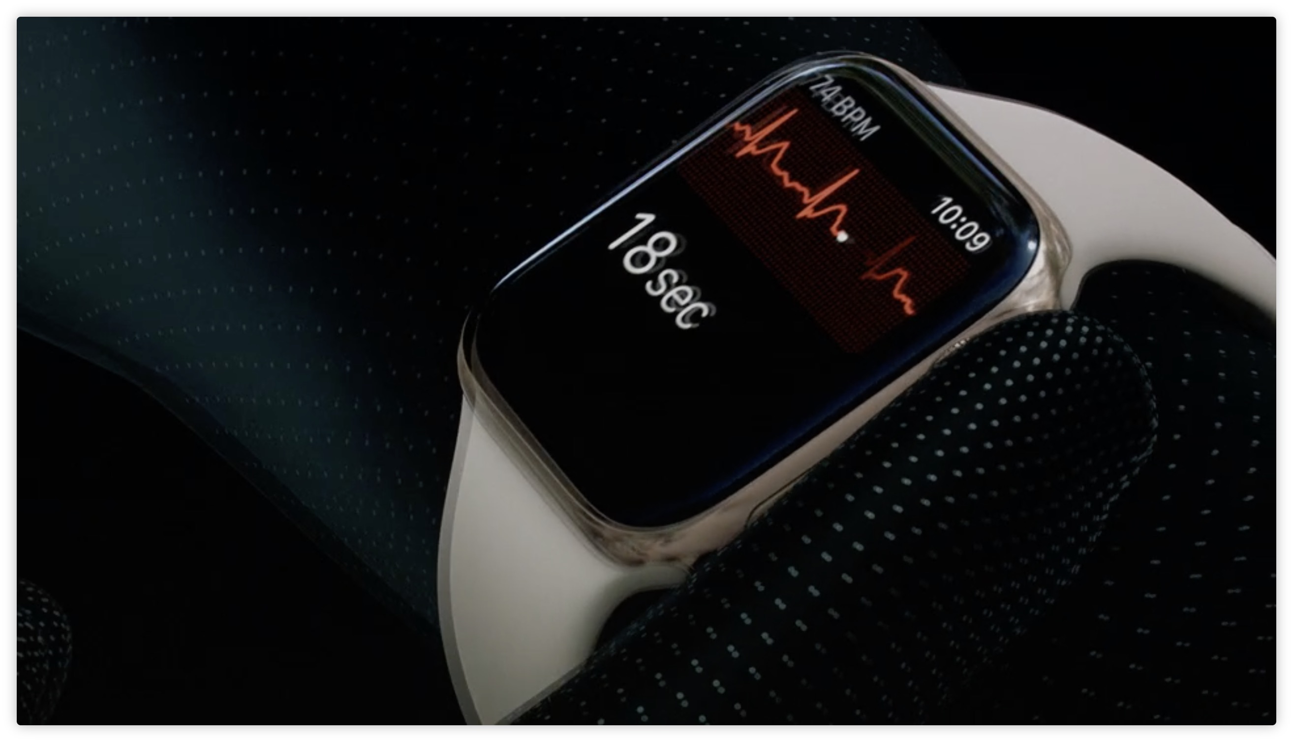 Apple Watch ECG檢測到醫院ECG遺漏的心臟病證據
